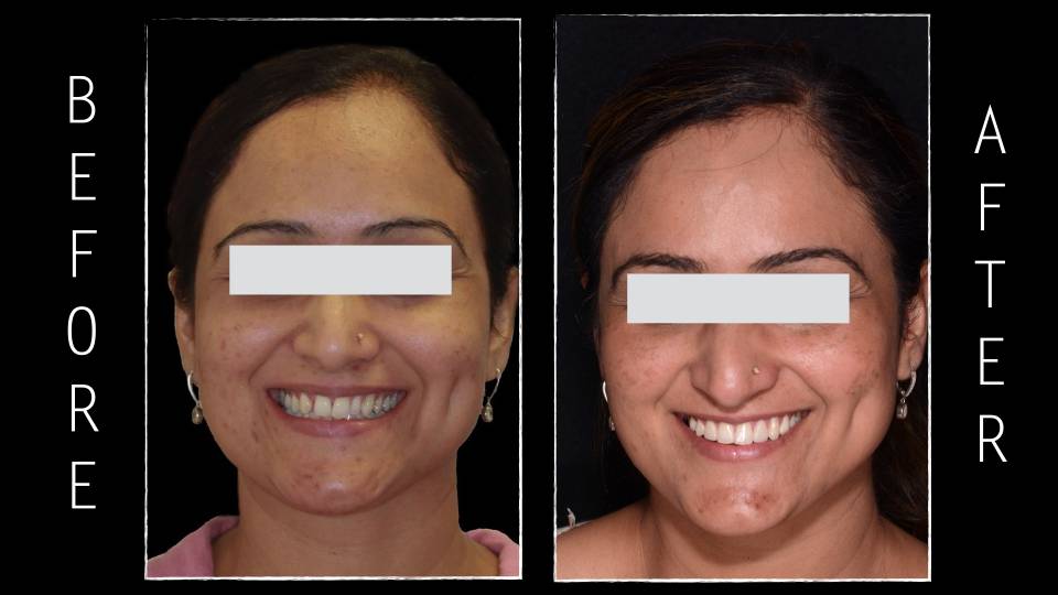 Patient case study
