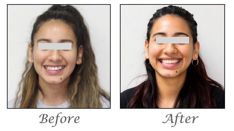Patient case study