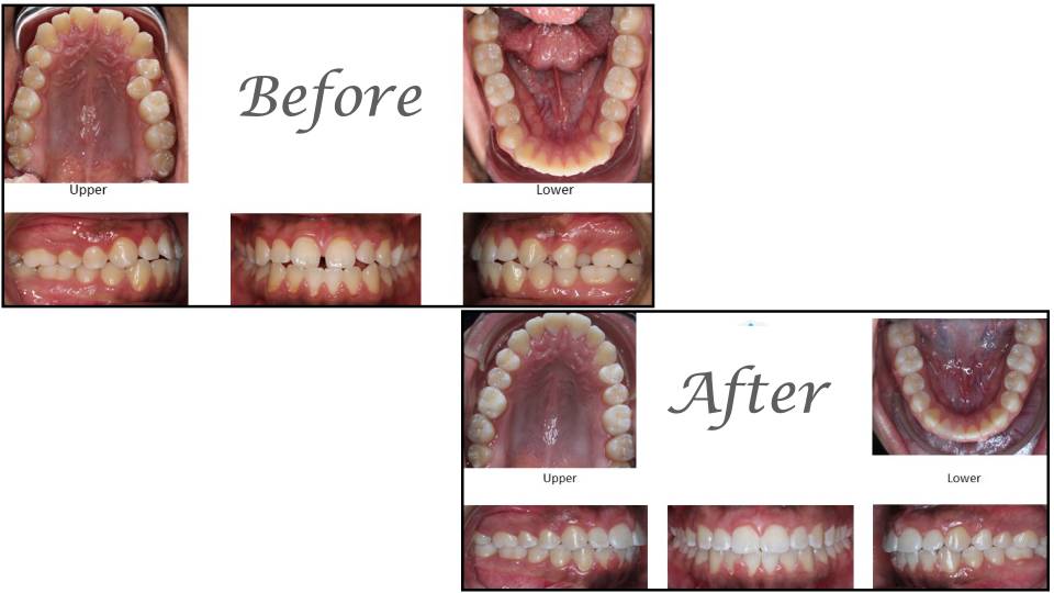Patient case study