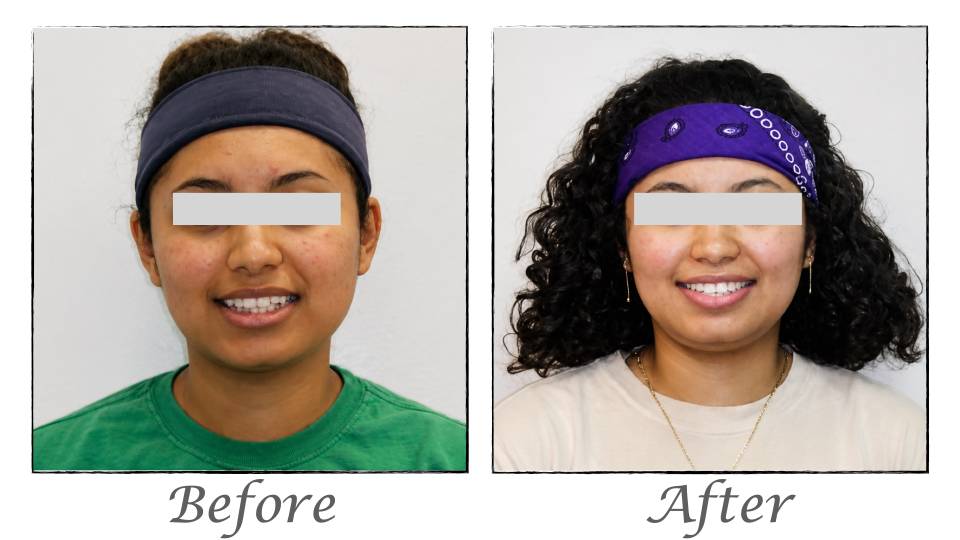 Patient case study
