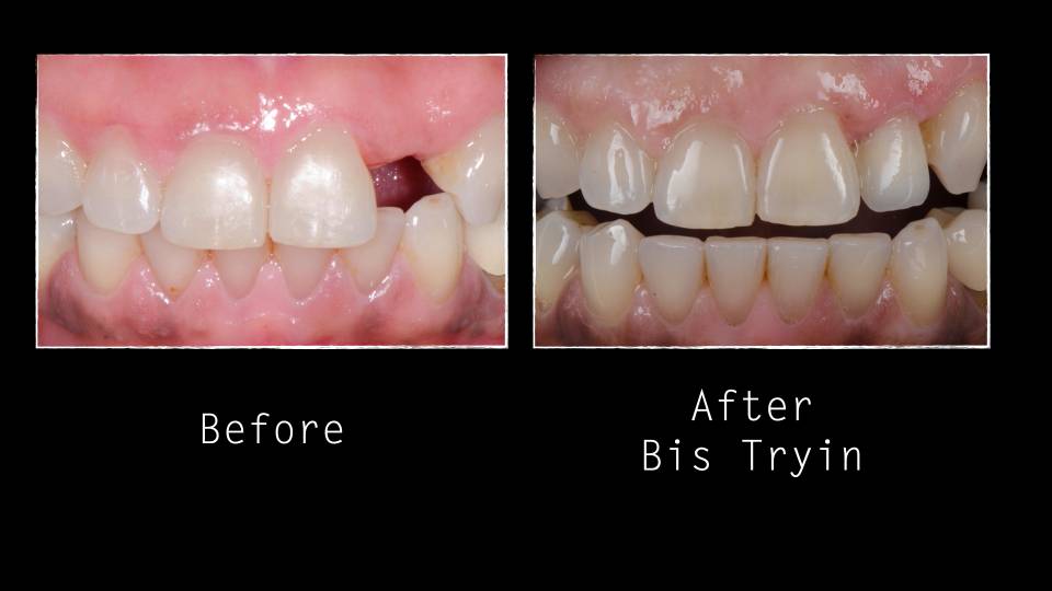 Patient case study