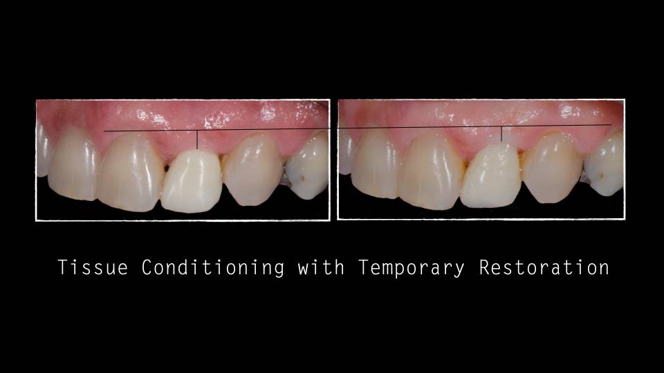 Patient case study