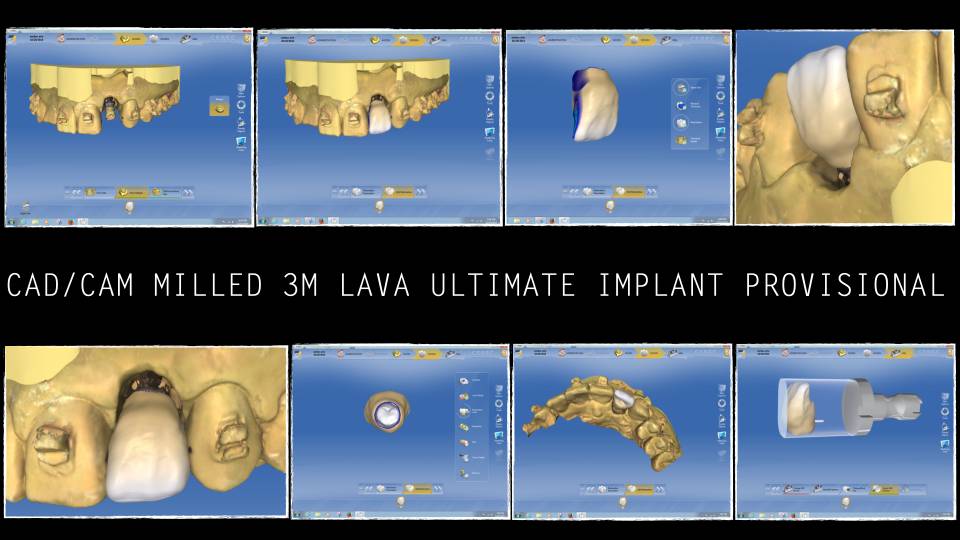 Patient case study
