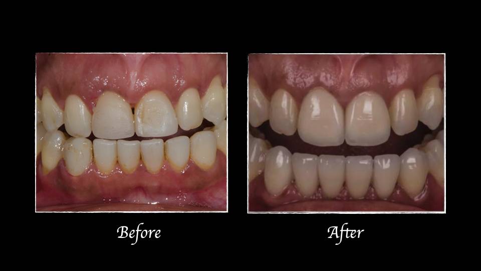 Patient case study