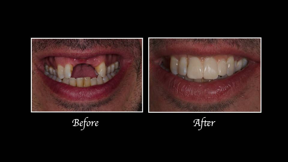Patient case study