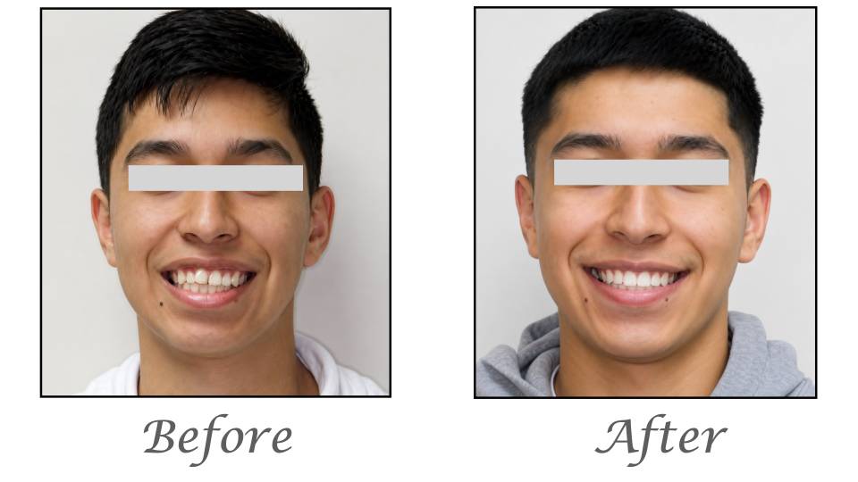 Patient case study