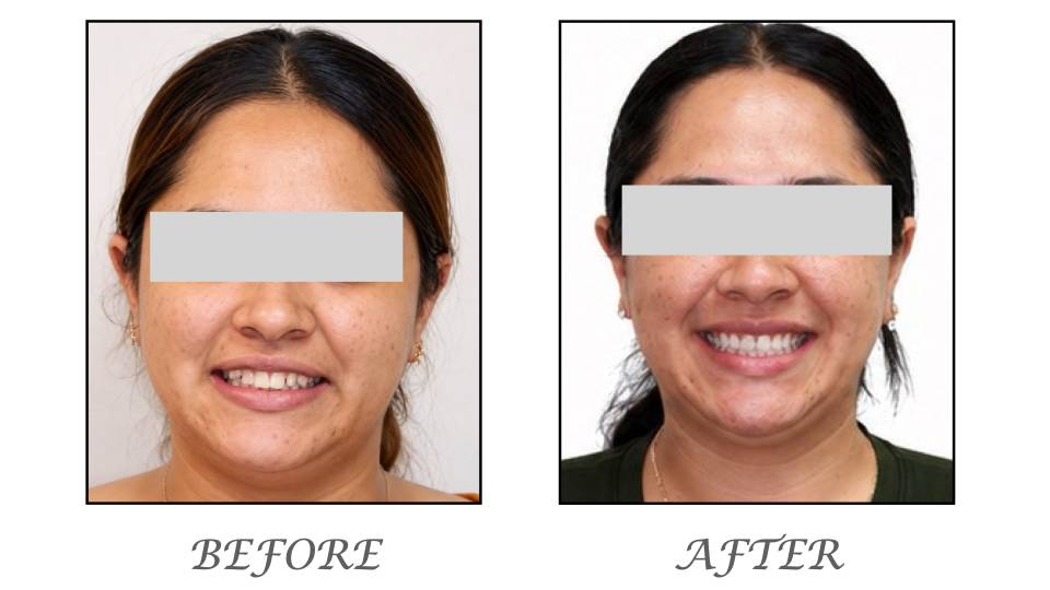 Patient case study