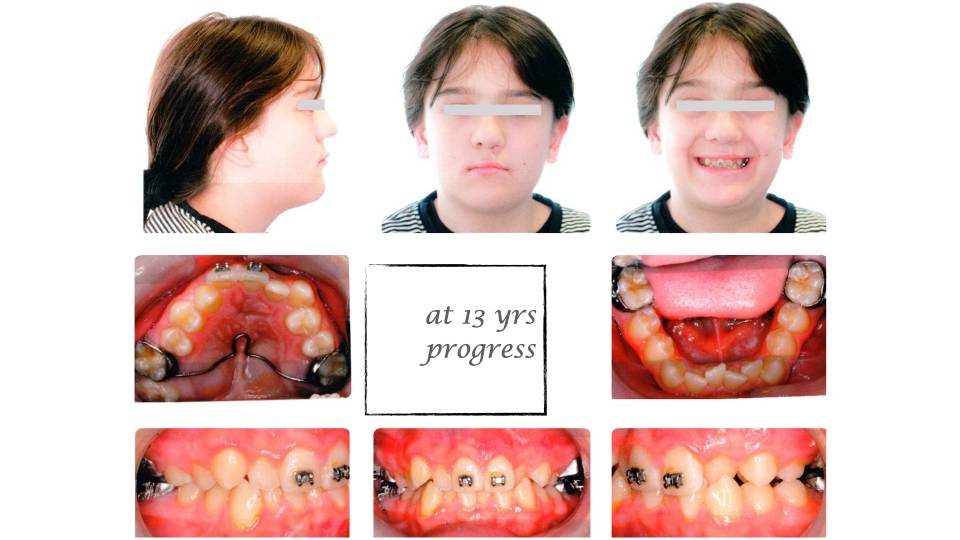 Patient case study