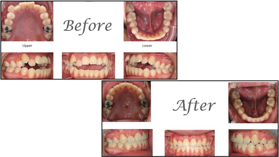 Patient case study