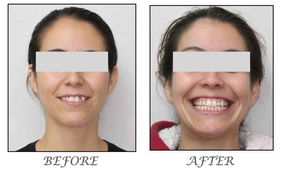 Patient case study